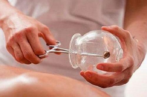 便秘拔罐哪个部位(便秘拔罐哪个部位视频)