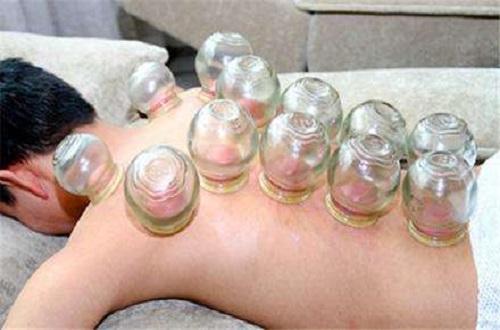 腰部拔罐位置示意图（腰部拔罐的正确位置图）