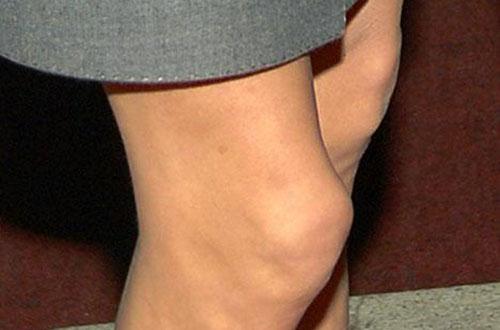 癌症的早期信号（男性癌症的早期信号）