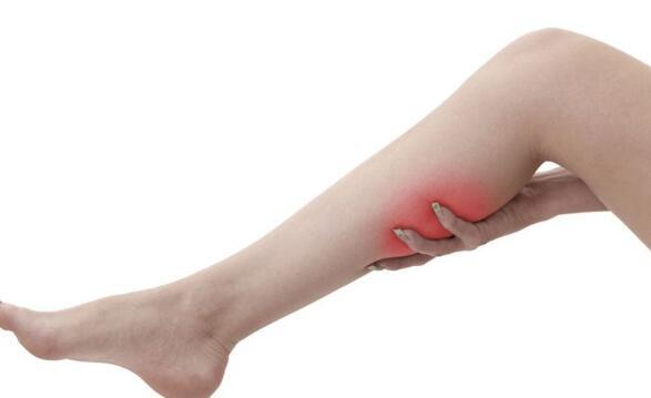 静脉曲张早期症状（静脉曲张早期症状及治疗方法）