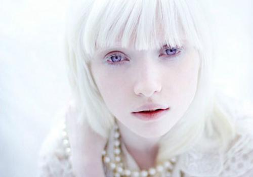 睫毛是白色的怎么回事 眼睫毛是白色的怎么回事