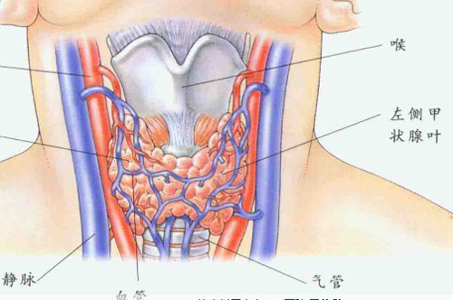 甲状腺癌的早期症状 甲状腺癌的早期症状图片
