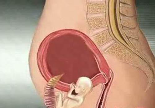 宫外孕腹腔镜手术后多久来月经（宫外孕腹腔镜手术后多久来月经从那天算）