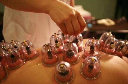 拔罐对前列腺炎有用吗 前列腺炎刺血拔罐效果怎么样