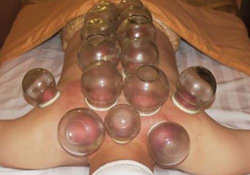 女人拔罐好还是刮痧好 女的拔罐还是刮痧好