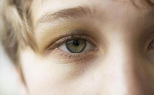 眼睛长了麦粒肿怎么办 2岁宝宝眼睛长了麦粒肿怎么办