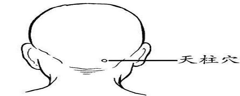 天柱的针刺方法 天柱针刺手法视频