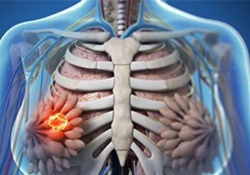 小叶增生对怀孕有影响吗（怀孕会加重小叶增生吗）