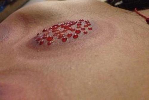 拔罐后罐印长时间不退怎么回事（拔罐后罐印很久不消是什么原因）