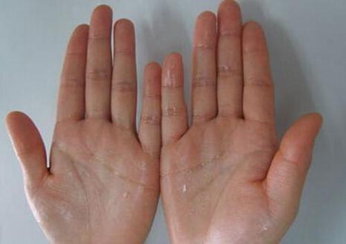 经常出汗是怎么回事（经常出汗是怎么回事女性吃什么药）