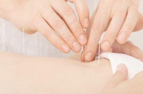 坐骨神经痛针灸位置图 坐骨神经痛针灸图