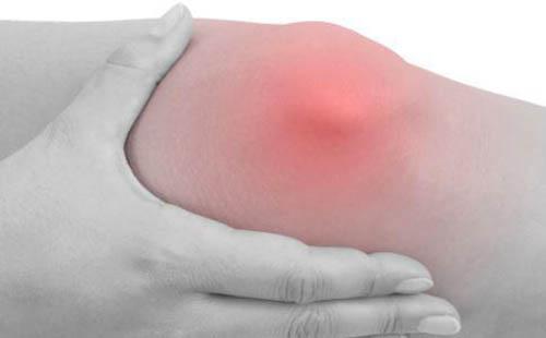 关节炎是怎么引起的 类风湿性关节炎是怎么引起的