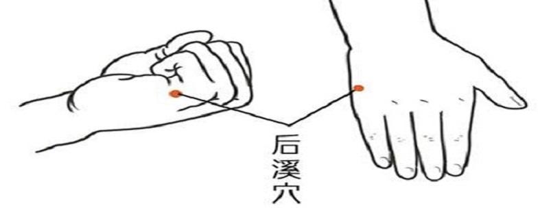 后溪针刺技巧（后溪针刺方法）