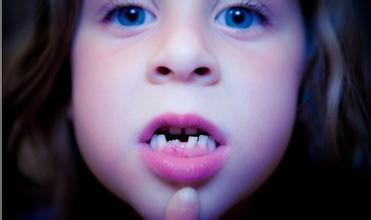 儿童换牙期注意事项 儿童换牙期注意事项和护理方法ppt