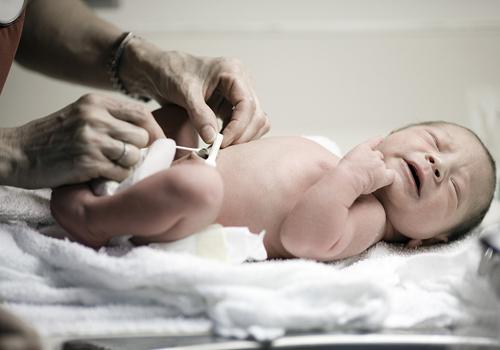 新生儿脐带有点化脓怎么办（新生儿脐带化脓了该怎么办）