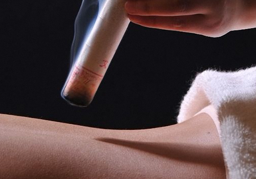 先拔罐好还是先艾灸好 先拔罐还是先艾灸?拔罐之后,这些事要了解