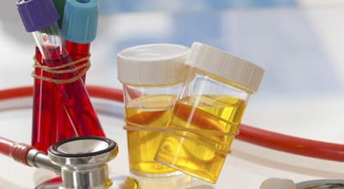 女性尿液发黄是怎么回事（女士尿液发黄怎么回事）