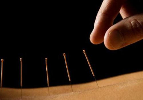 自闭症可以针灸吗(自闭症扎针灸扎有用吗)