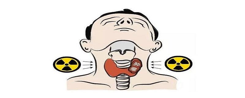 甲状腺癌的发病原因是什么（甲状腺癌的发病因素）