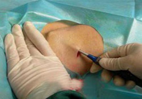 狐臭的味道像什么味道 狐臭的臭味是什么味的