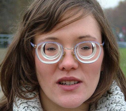 高度近视的危害 儿童高度近视的危害