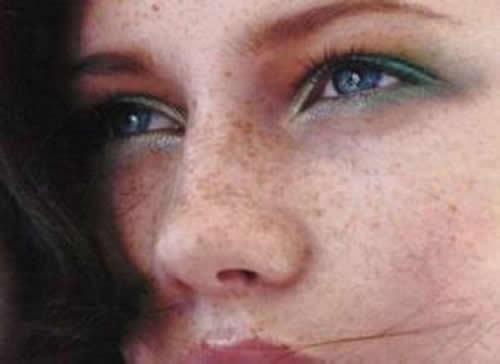 生完孩子后怎么去斑 生完孩子后斑怎么去掉