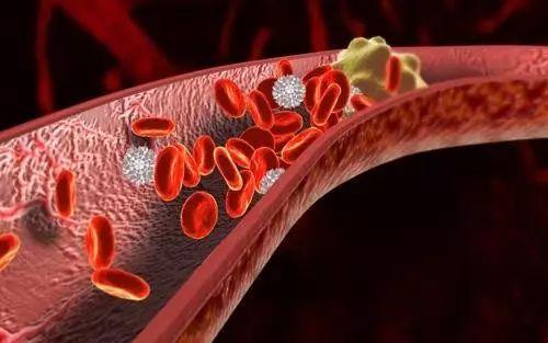 血管老化的原因（血管老化的原因有哪些）