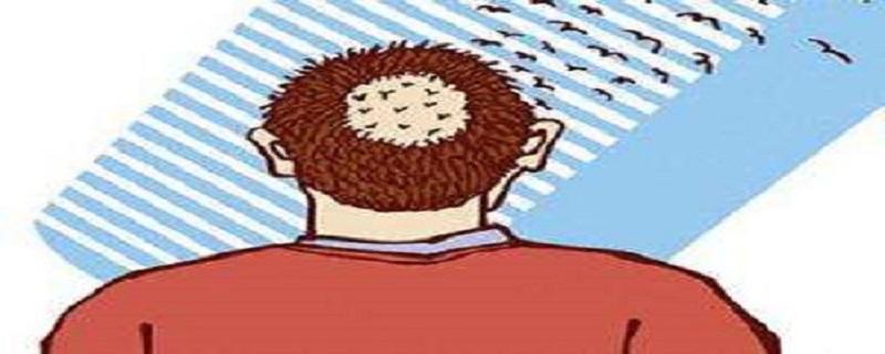 斑秃艾灸哪里 艾灸治疗斑秃的部位