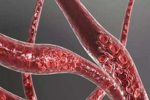 睾丸静脉曲张是怎么形成的 睾丸静脉曲张怎么形成的原因