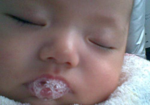 宝宝吐泡泡就是肺炎吗 婴儿吐泡泡就是肺炎?