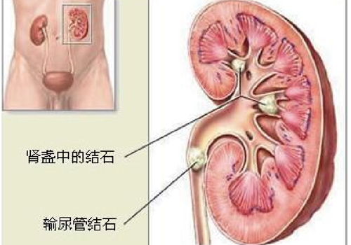 肚子胀尿少怎么回事 腹胀尿少是怎么回事