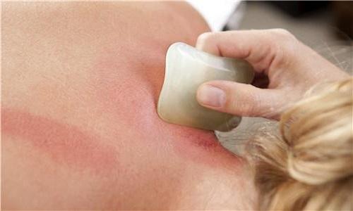 牙疼刮痧刮哪里图解（牙疼刮痧刮哪个部位图片）