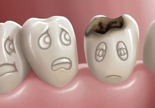 蛀牙是不是真的有虫 蛀牙是不是真的有虫卵