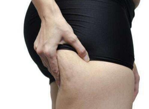 夏天水肿怎么办(夏天水肿怎么办?)