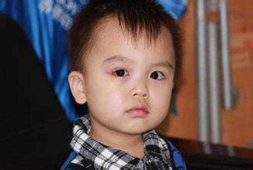 结膜炎怎么办才能好的快(结膜炎怎么办才能快速好)