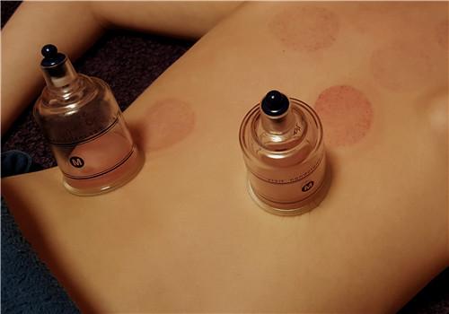 拔罐拔出血是怎么回事 拔罐的出血怎么回事