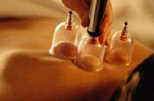 中暑拔罐位置图 中暑拨罐拨什么地方