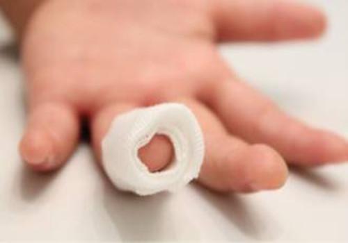 运动后手指肿胀是怎么回事 运动后手指肿胀怎么办