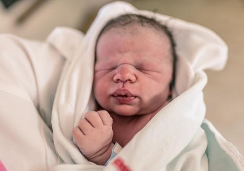 宝宝头发里有像头皮屑一样的东西怎么回事 5招去除这些头皮屑!