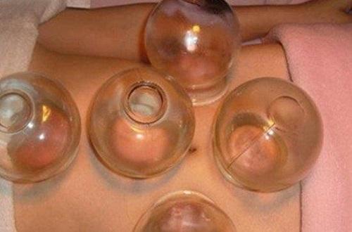 胸部拔罐的好处和坏处 胸脯拔罐儿有害处吗?