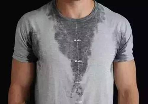 为什么紧张会出汗