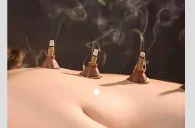 甘油三酯高艾灸哪里（甘油三酯高扎针灸好吗）