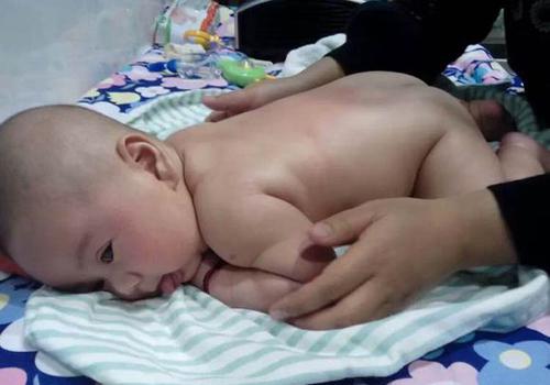 婴儿屁股青是怎么回事 婴儿屁股发青怎么回事