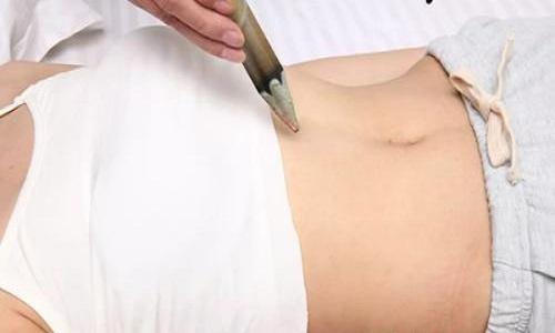 消化不良艾灸哪里最好 消化系统不好艾灸哪里