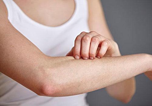 皮肤过敏不能吃什么 皮肤瘙痒吃什么好