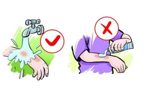 烫伤后的正确处理方法（烫伤后的正确处理方法是）