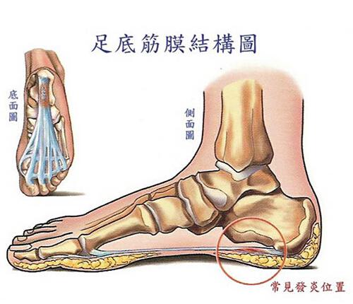 脚跟底部疼是怎么回事 脚跟底部疼怎么办