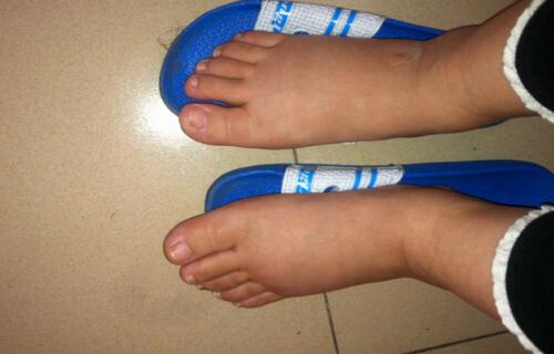 坐久了脚肿是什么原因 站久了坐久了脚肿是什么原因