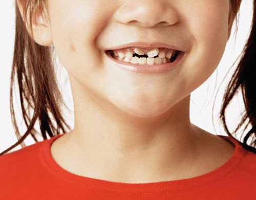 儿童换牙期间吃什么好 儿童换牙期间吃什么好补钙