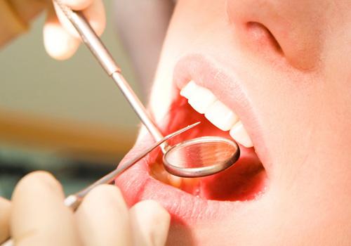 口腔溃疡是怎么回事（口腔溃疡是怎么回事?缺什么?）